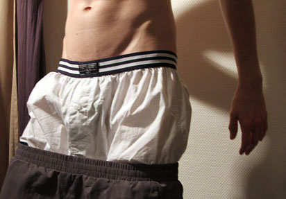 Extreme sag